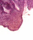 Gall bladder, microscopic