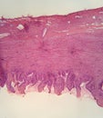 Gall bladder, microscopic cross section