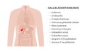 gallbladder anatomy poster