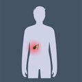 gallbladder disease poster