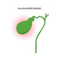 gallbladder disease poster