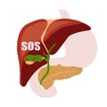 Gallstones. A fit of pain. Digestive organs. Liver, pancreas, gallbladder.Vector.