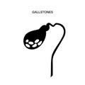 gallbladder stones anatomy