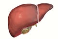 Gallstones, illustration showing front view of liver and gallbladder with stones