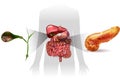 Gallstones, pancreatitis Royalty Free Stock Photo