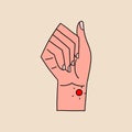 Ganglion cyst. Vector illustration in flat style