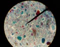 Gardia lamblia protozoa with trichrom stain.