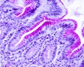 Gastric mucosa. Epithelium