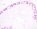 Gastric mucosa. PAS method