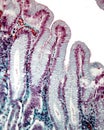 Gastric pits. Masson trichrome stain