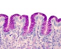 Gastric pits. PAS stain