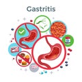 Gastritis disease symptoms causes medicine flat circular composition of healthy and affected stomach bacteria food vector