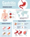 Gastritis symptoms stomach ulcer causes information on unhealthy food habits world population affected infographic poster vector