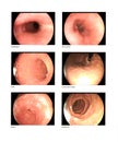 Gastrointestinal endoscopic examination Finding esophagus EG junction body cardia with fundus antrum duodenum normal contains Royalty Free Stock Photo