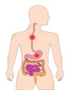 Gastrointestinal