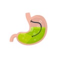 Gastroscopy. Endoscopy and digestive problems. Hose with camera. Procedure with internal organs