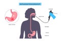 Gastroscopy endoscopy procedure