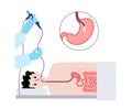 Gastroscopy endoscopy procedure