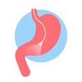 Gastroscopy icon. endoscope with light in stomach. Medical exam. inspection of stomach. digestive problems. Hose with