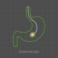 Gastroscopy Procedure Icon