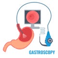 Gastroscopy procedure of stomach examination with endoscope