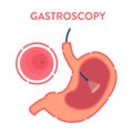 Gastroscopy procedure of stomach examination Royalty Free Stock Photo