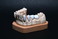 Gebiss / Teeth Royalty Free Stock Photo