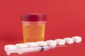 General urine test in a medical container and white sugar cubes with a syringe. Copy space. Selective focus Royalty Free Stock Photo