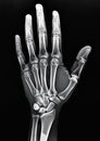 X-ray image of a human hand showing detailed skeletal structure. Royalty Free Stock Photo