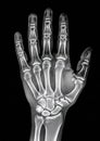 X-ray image of a human hand showing detailed skeletal structure. Royalty Free Stock Photo
