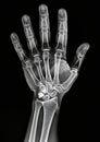 X-ray image of a human hand and wrist, showing detailed bone structures. Royalty Free Stock Photo