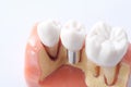 Generic dental teeth model