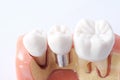 Generic dental teeth model