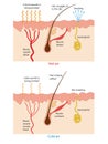 Heat and perspiration from the skin. The mechanism body temperature regulation