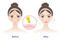 Before and after get used sunscreen on woman face vector illustration isolated on white background.