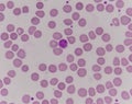 Giant platlet on red blood cells