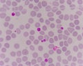 Giant platlet on red blood cells