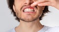 Gingival inflammation and dental problems. Guy pushes his lip up and shows red gum Royalty Free Stock Photo