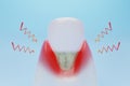 Gingival Recession or inflammation for dental clinic