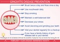 Gingivitis Disease Prevention Infographic Vector Illustration