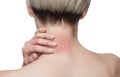 Girl with blond hair, sitting with his back turned and scratching bitten, red, swollen neck skin from mosquito bites in the summer