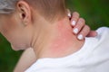 Girl with blond hair, sitting with his back turned and scratching bitten, red, swollen neck skin from mosquito bites