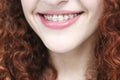 Girl in braces with curly red hair. Close up