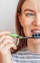 A girl with braces on her teeth smiles and holds a toothbrush