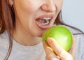 A girl with braces on her teeth wants to bite a green apple Royalty Free Stock Photo