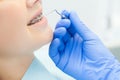 Girl with braces at the reception at the dentist. Close-up. Hand with the instrument at the patient`s teeth