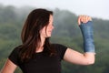 Girl broken arm Royalty Free Stock Photo