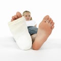 Girl with a broken leg Royalty Free Stock Photo