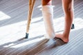 Girl with a broken leg .close-up of feet, one with a plaster bandage. foot splint for treatment of injuries from broken Royalty Free Stock Photo