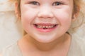 A girl, a child lost a tooth, hole, oral hygiene Royalty Free Stock Photo